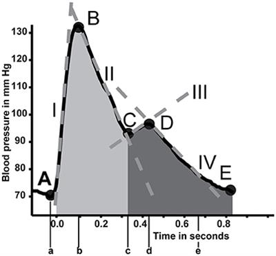 Support Vector Machine Based Monitoring of Cardio-Cerebrovascular Reserve during Simulated Hemorrhage